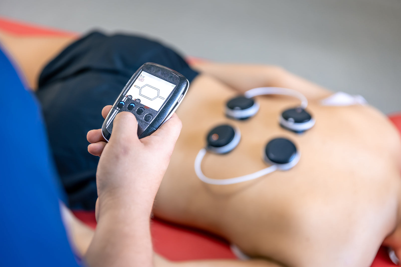 EMS and TENS: Different Tools for Different Jobs (and Why the Abs Stimulator Market Is a Scam)