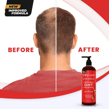 DHT Blocker Anti Hair Loss Shampoo and Conditioner set with Biotin (2 x 16 Oz)